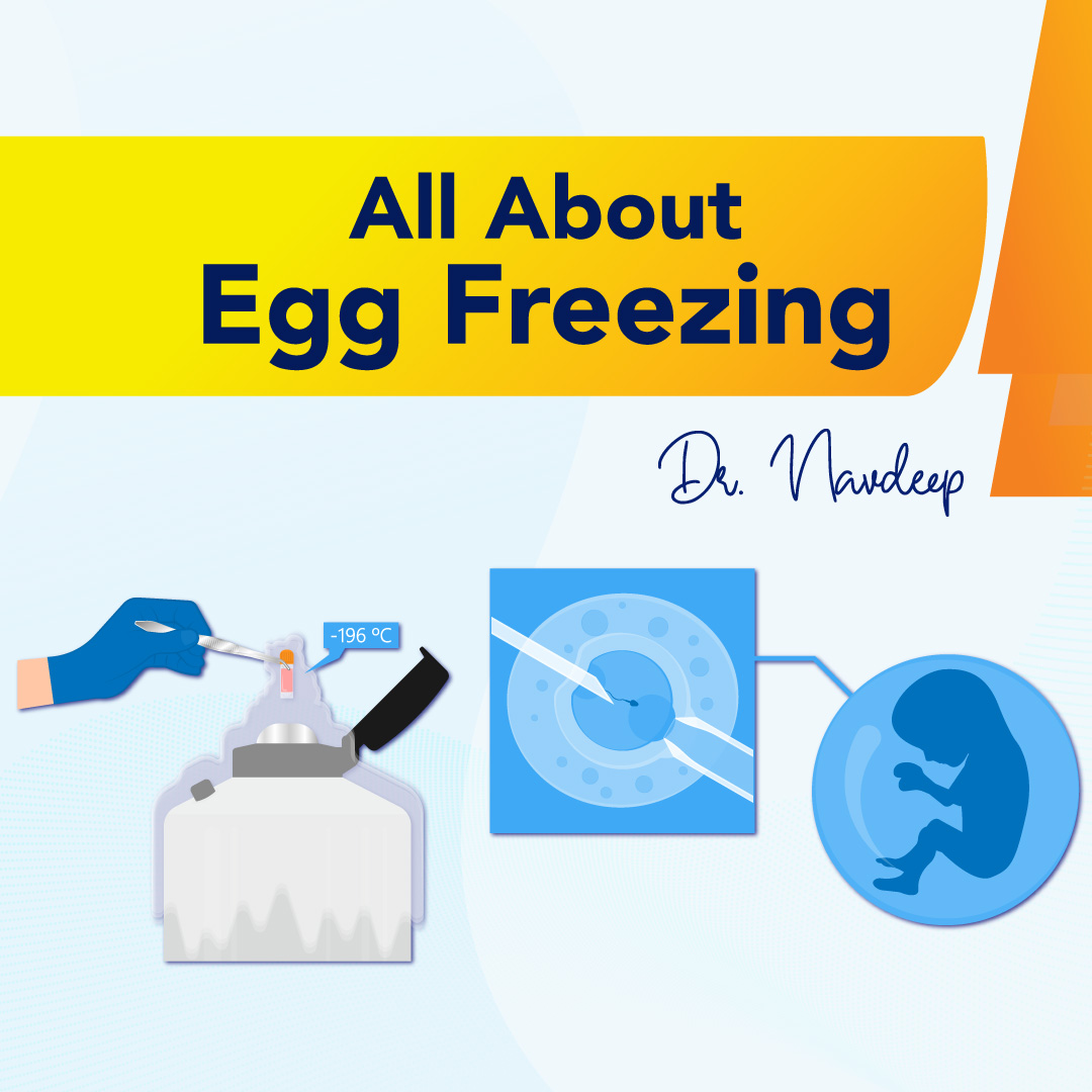All About Egg Freezing