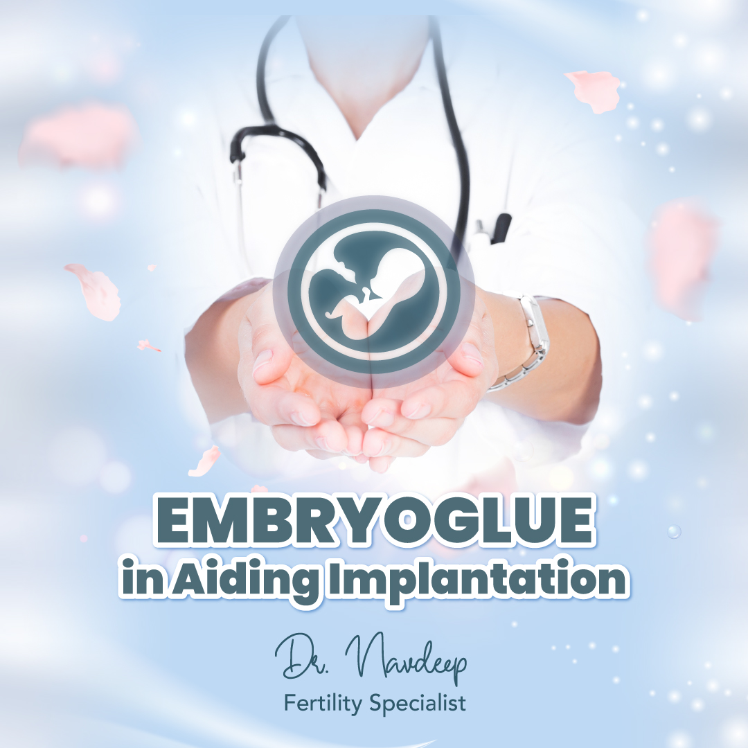 EmbryoGlue in Aiding Implantation
